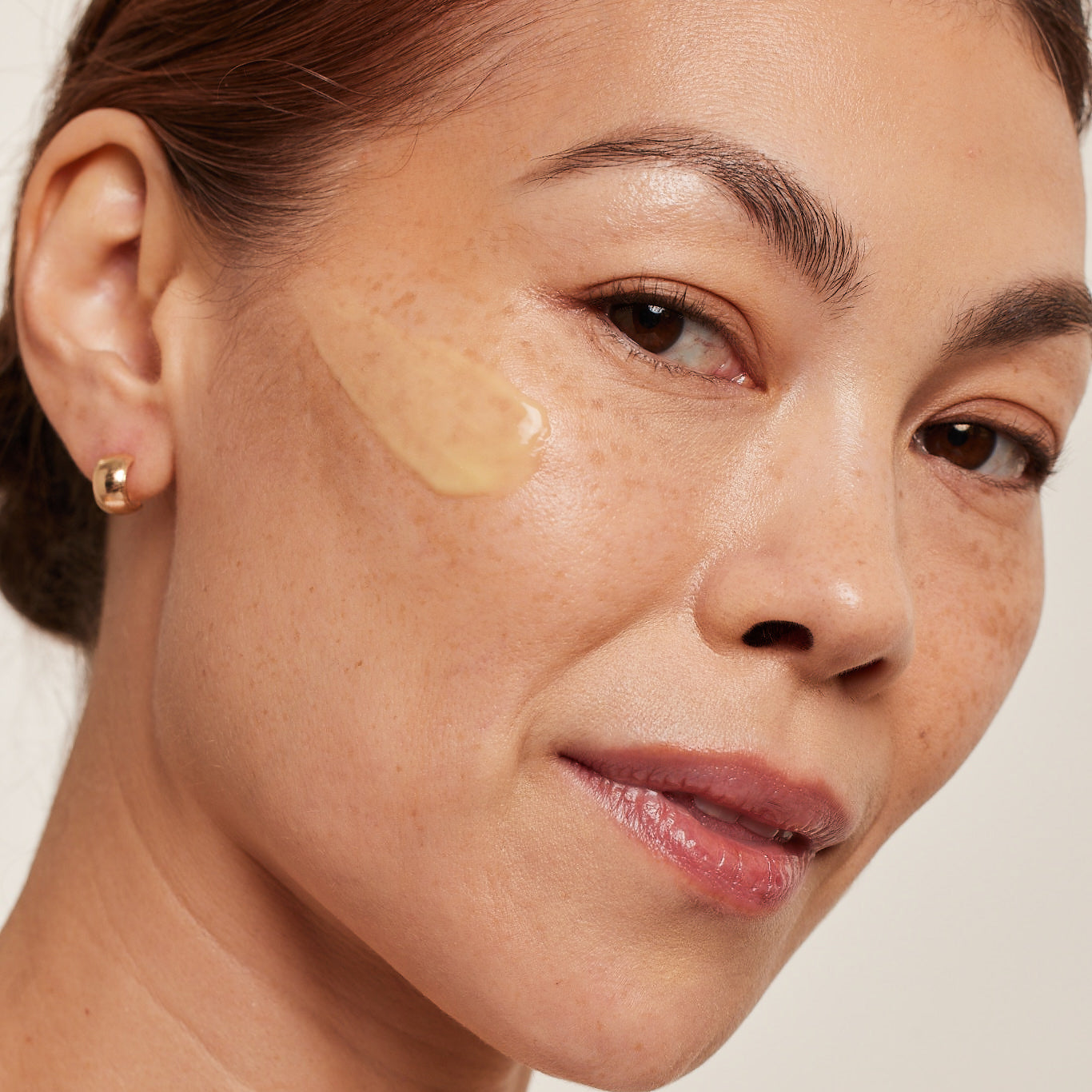 Woman uses Malassezin instead of Vitamin C for her dark spots