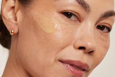 Woman uses Malassezin instead of Vitamin C for her dark spots