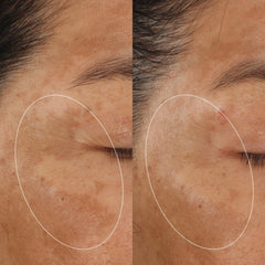 MOLECULAR HERO SERUM DUO