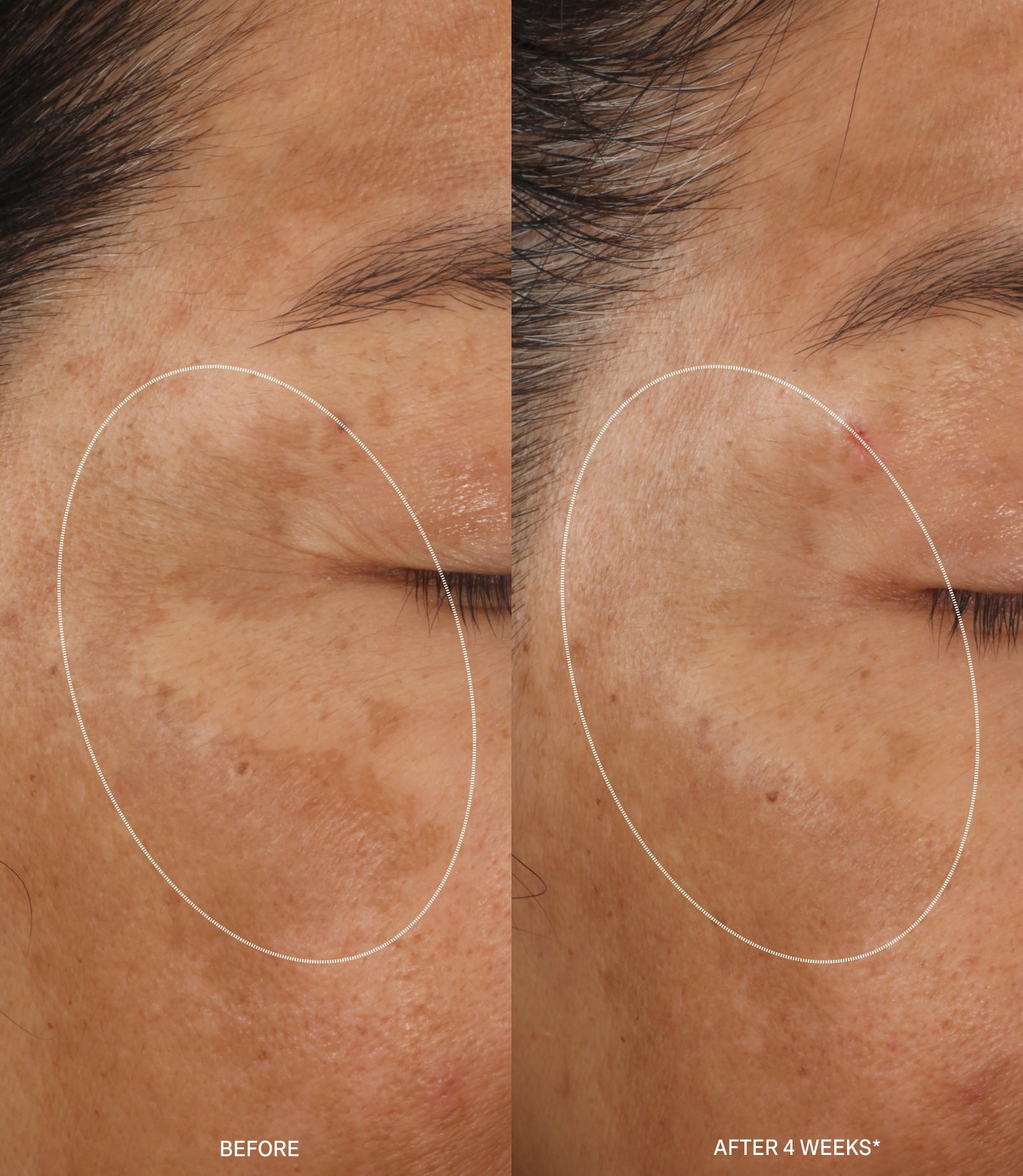 MOLECULAR HERO SERUM DUO