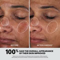 MOLECULAR HERO SERUM DUO