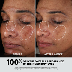 MOLECULAR HERO SERUM