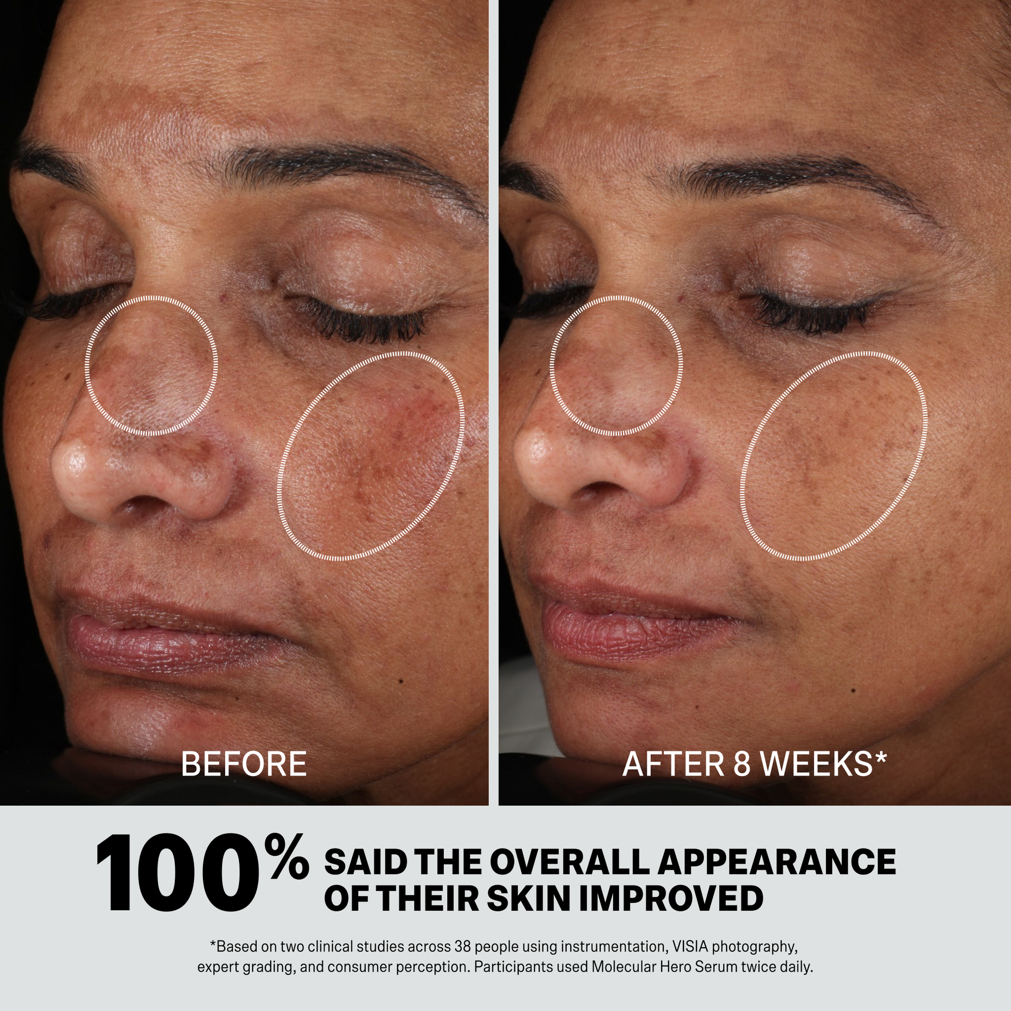 MOLECULAR HERO SERUM