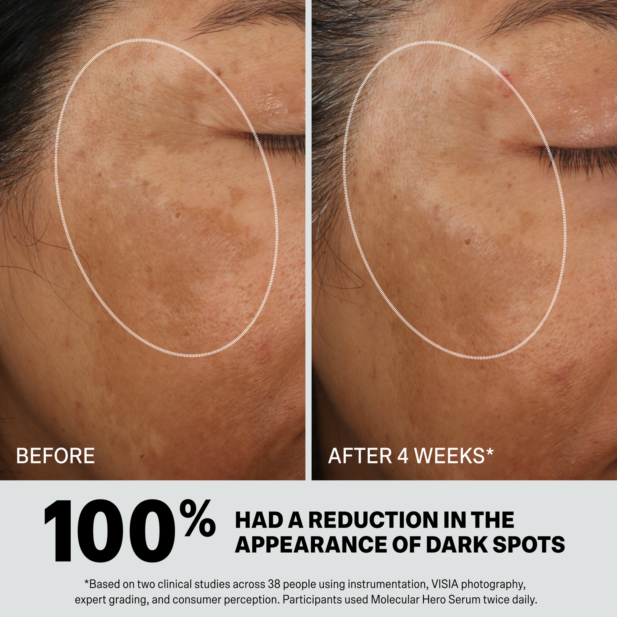 MOLECULAR HERO SERUM