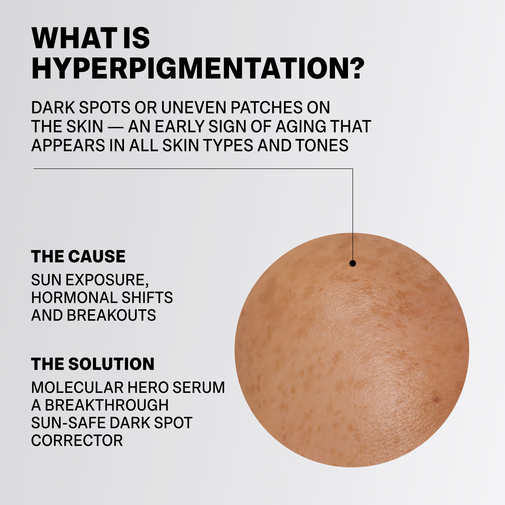 MOLECULAR HERO SERUM